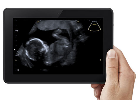 Baby Scan on Tablet